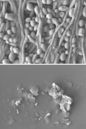 Scanning electron microscopy images of Candida albicans biofilm
