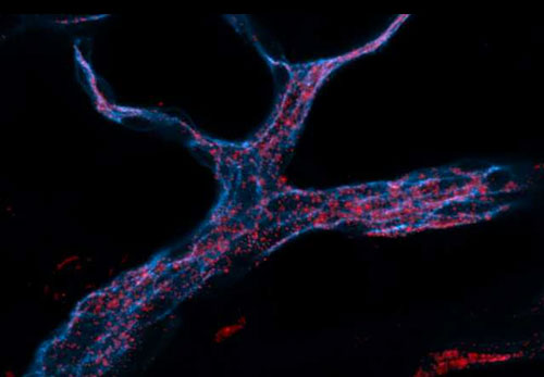 RNA-carrying nanoparticles (red) that can be taken up by endothelial cells (stained blue)