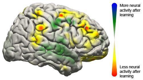 brain-computer interface brain image showing activity changes