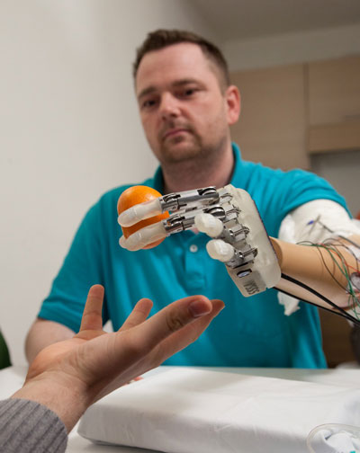 The patient Dennis Aabo Sorensen grasps at a mandarin orange with his artificial hand