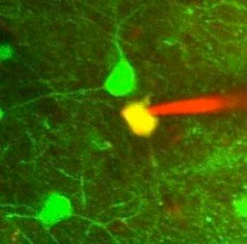 a patched neuron