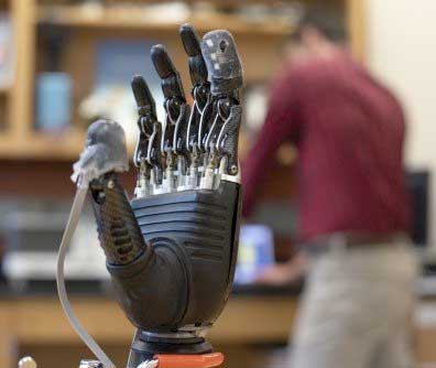 A prosthetic hand equipped with the experimental e-dermis