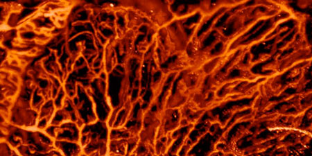 Optoacoustic imaging of blood vessels