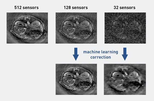 optoacoustic tomography images