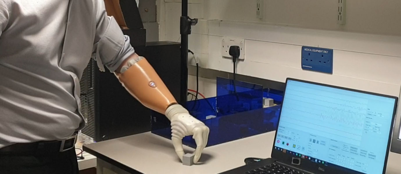 robotic hand prosthesis