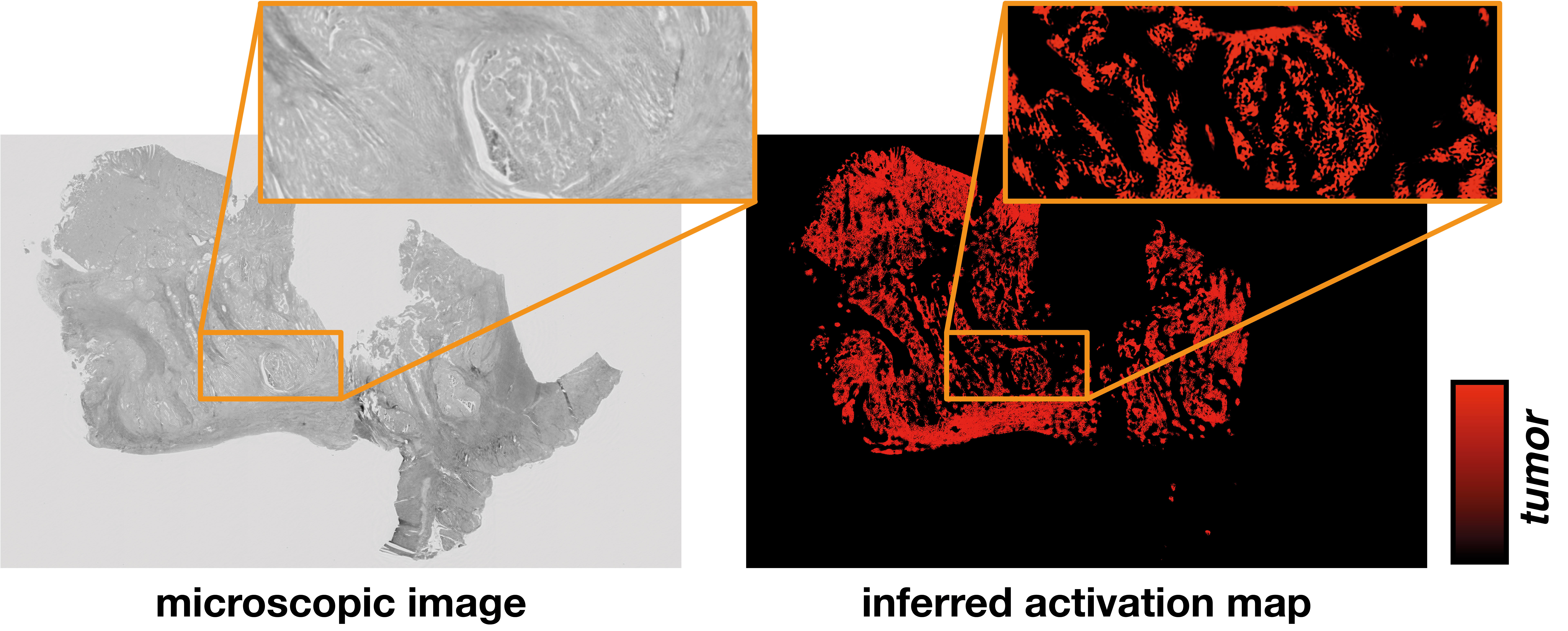 neural network derived activation map (on the right) from the microscopic image of a tissue sample (on the left)