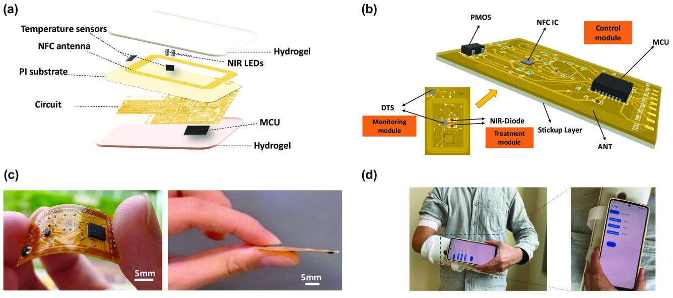 e-Bandage structure and composition