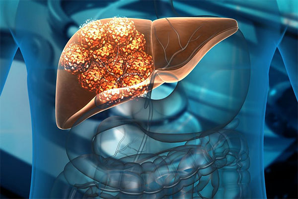 Guided by an external magnetic field, miniature biocompatible robots, made of magnetizable iron oxide nanoparticles, can theoretically provide medical treatment in a very targeted manner