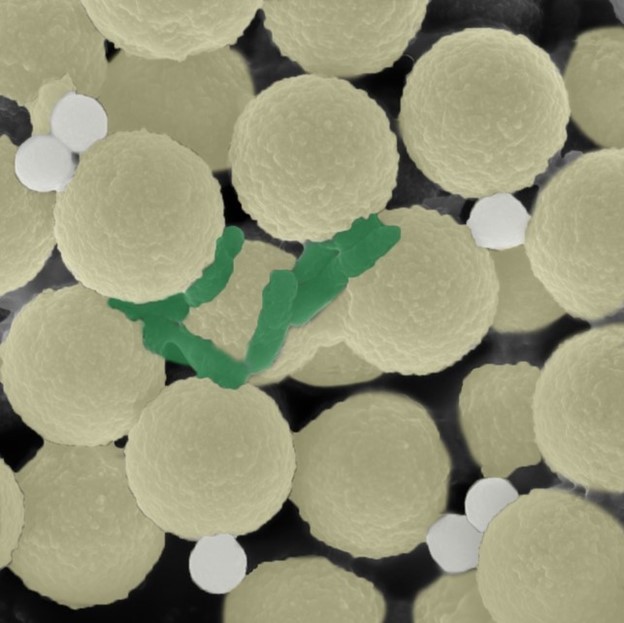 swarms of tiny, spherical robots that collect bacteria and small pieces of plastic
