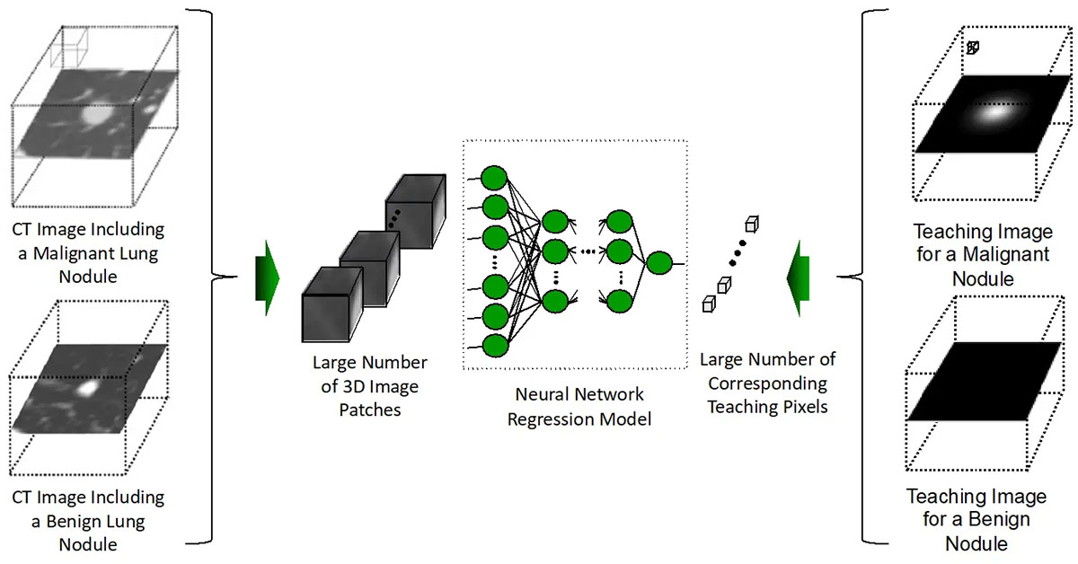 Ultra-lightweight artificial intelligence model for efficient cancer diagnosis