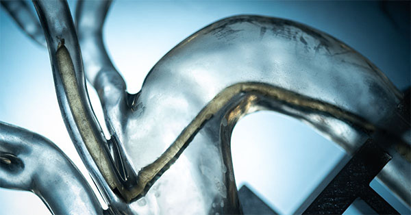 robot navigates a model of human arteries