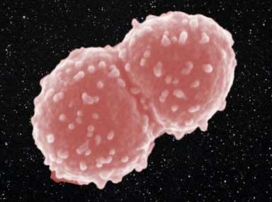 Deinococcus radiodurans