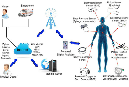 Illustration of an architecture for remote healthcare monitoring system