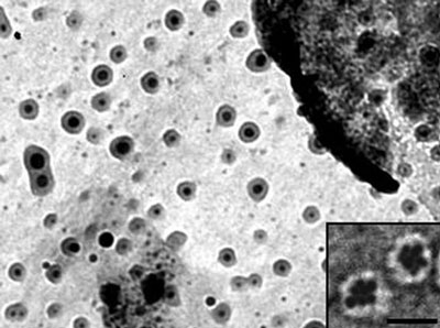 TEM image of gold nanoparticles encapsulated within DNA icosahedra