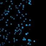 captured_cancer_cells
