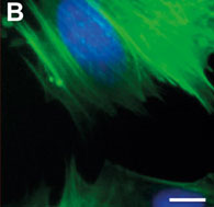 fluorescently-labeled actin filaments (green) are not detectable at the border between two different cells with the optical microscope
