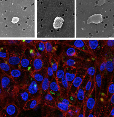 HeLa cells growing on polystyrene surfaces decorated with inclusion bodies formed by a fluorescent GFP variant