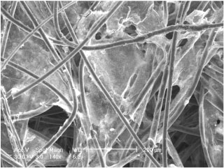 SEM image showing large scale structure of cotton fibers