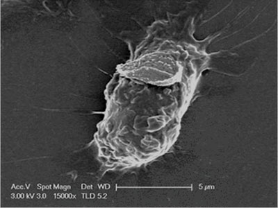 HA coated backpack attached to the surface of a macrophage