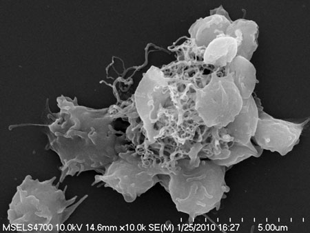 Scanning electron microscopy image shows platelet activation by multiwallled carbon nanotubes
