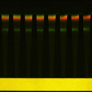simultaneous separation and concentration of a green and red protein, and DNA