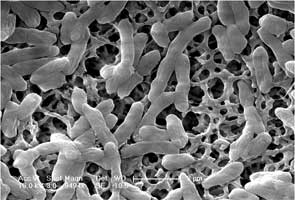 E.coli cells without carbon nanotubes