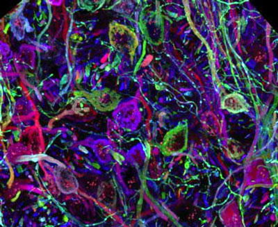 confocal microscopy image from the brain stem with fluorescently labelled neurons