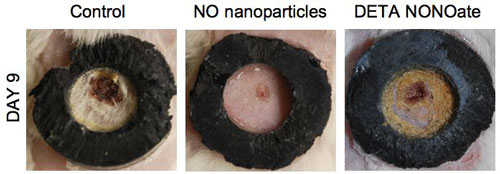 nitric oxide (NO) releasing nanoparticle platform for wound healing