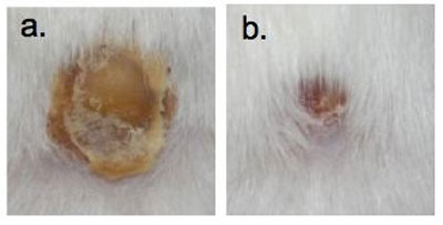 NO nanoparticles accelerate thermal burn wound healing in setting of candida infection