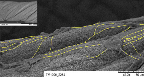 neural stem cells on cerbon nanotube rope