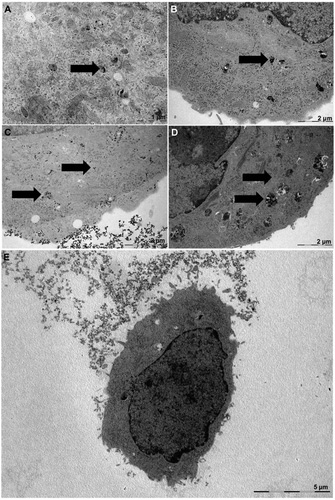 Transmission electron microscopy images of lung cancer cells exposed to silica nanoparticles in serum-containing and serum-free media