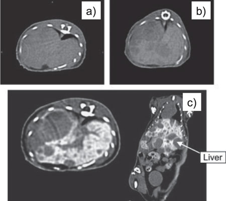 CT images of cancerous liver of a mouse