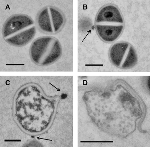Curcumin nanoparticles induce cellular damage of MRSA