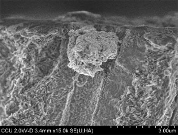 dentinal tubule filled with gold nanoparticles