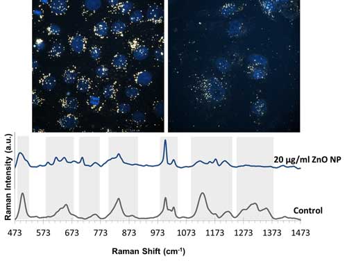enhanced-dark field images of A549 cells incubated with gold nanoparticles
