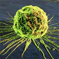 cancer_cell