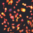 cancer_cells