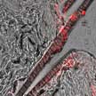 epidermis_with_nanoparticles