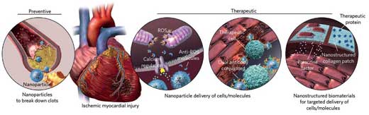 Applications of various nanoplatforms in the prevention and treatment of cardiovascular disease