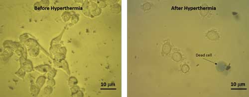 Representative bright field microscopic images of HeLa cells with ferrite coated nanomotors  (a) before and (b) after hyperthermia run