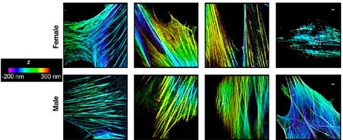 Super-resolution images demonstrating differences between organization, distribution, and morphology of actin filaments/bundles in the cytoplasm of amniotic mesenchymal stem cells