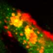 stem_cells