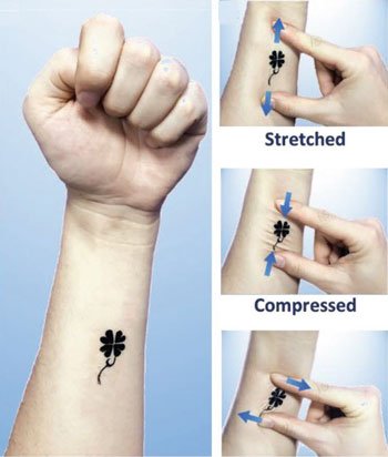 Photographs showing a four-leaf clover e-tattoo attached to the forearm