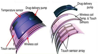 Schematic representation of drug delivery system with micropump assembly