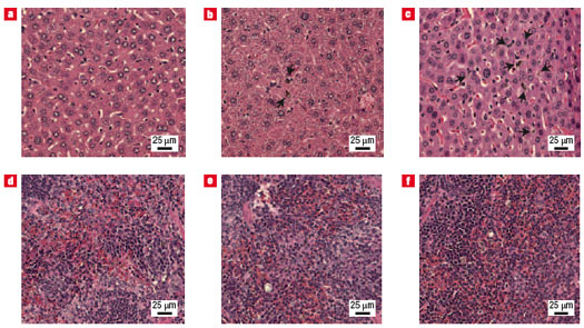 Liver and spleen histology of injected carbon nanotubes