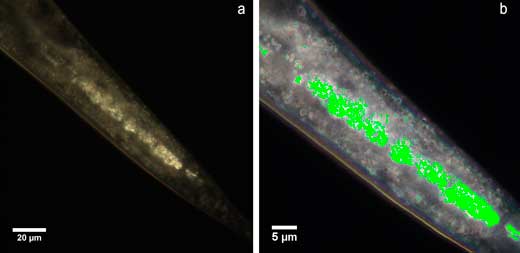 distribution of polystyrene microparticles in C. elegans