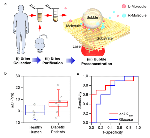 Schematic illustration of the collection and purification of urine samples, and the microbubble enabled accumulation of chiral metabolic molecules on chiral metasurface for enhanced chiral sensing and diabetic detection