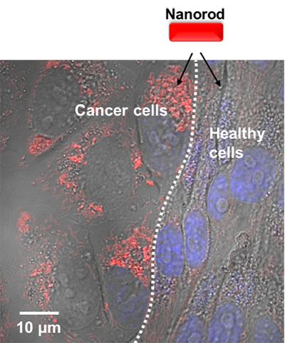 A mixed co-culture of breast cancer and healthy cells with nanorod uptake