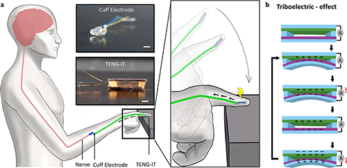 Illustration of an integrated tactile (IT) sensory restoration device
