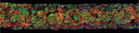 Longitudinal microscopy image of a fiber core overtaken by cancer cells
